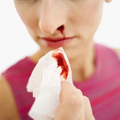 Home Remedies for Nose Bleeding